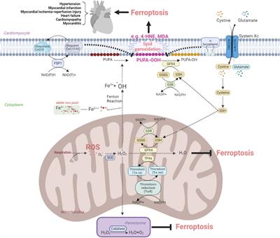 The underlying pathological mechanism of ferroptosis in the development of cardiovascular disease